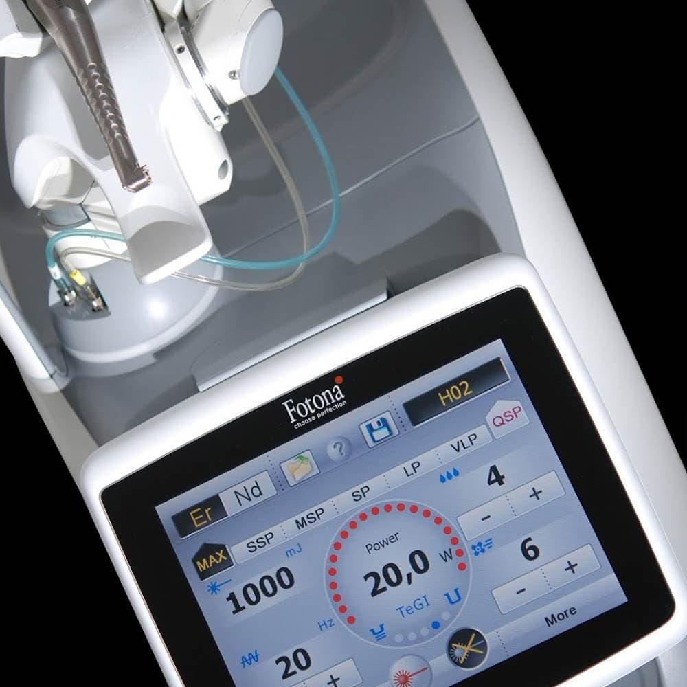 Fotona Laser Treatment