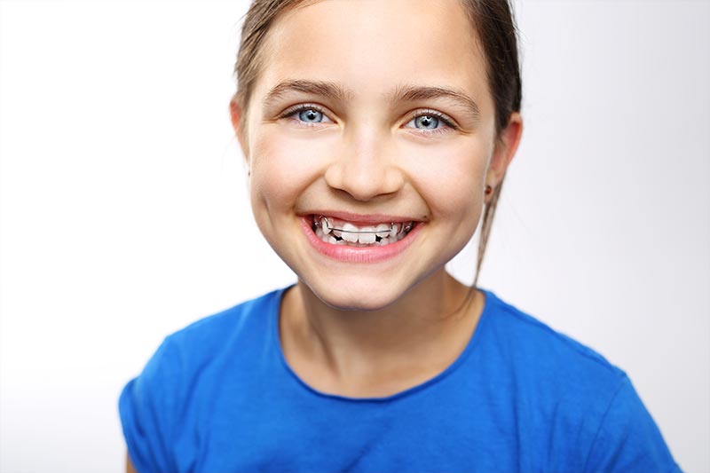 Phase 1 Orthodontics